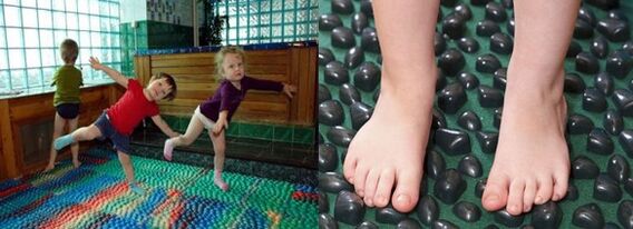 Γυμναστική για παραμόρφωση Valgus